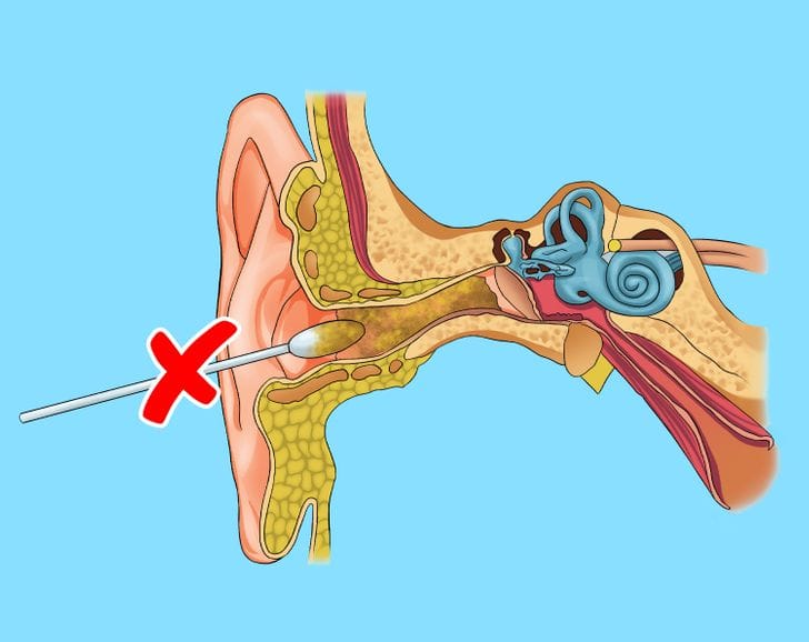 Những sai lầm khi làm sạch tai cho trẻ sau bơi